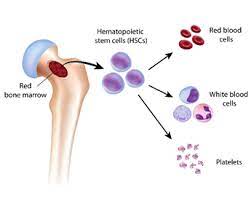 Stem Cell Transplant