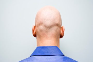 BALD