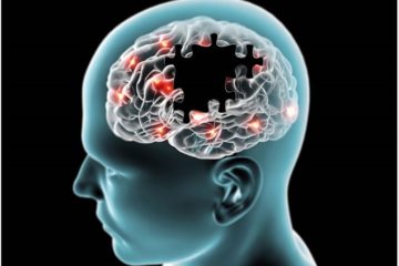 Alzheimer's Disease