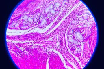 a close up of a section of a human's stomach